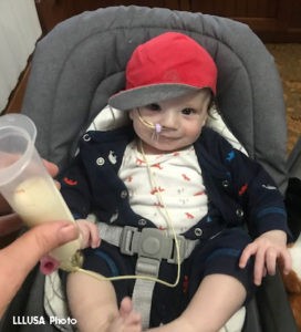 Bhodi smiling at the camera, you can see his feeding tube